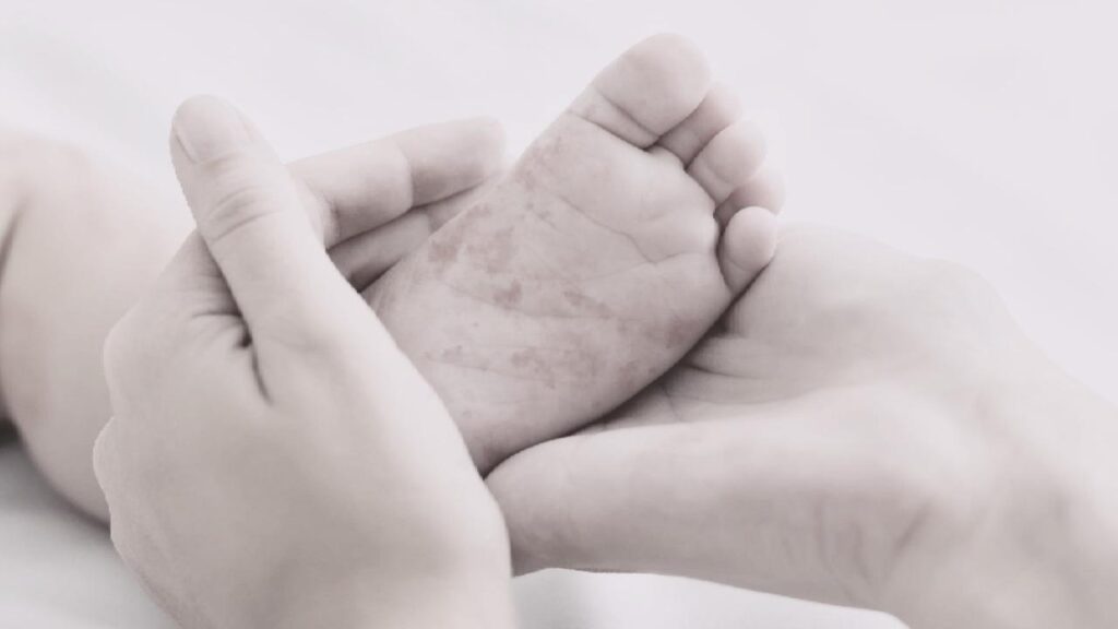 Aumentan a 22 los casos de sarampión en Tomatlán; intensifican el cerco epidemiológico en la zona