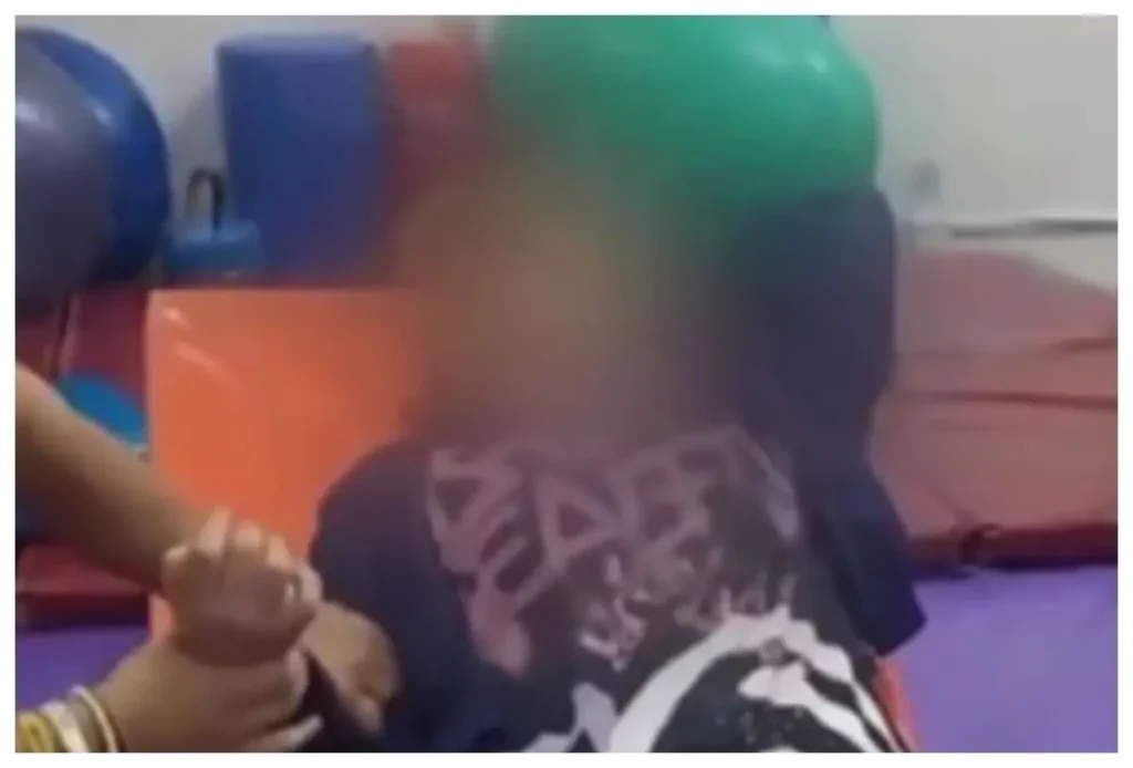 Joven sufre un accidente cerebrovascular tras una rinoplastia para sus XV años en una clínica de la CDMX